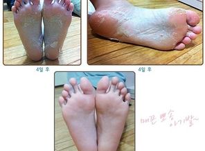 getImage (7)