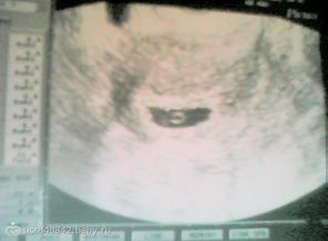 Picture0377