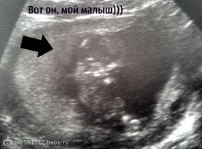 мой малыш в 12.0 недель