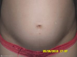 22 недельки