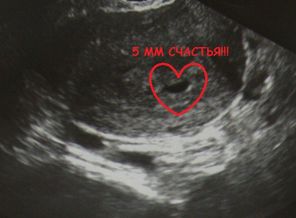 5мм