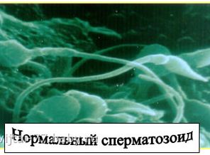 вот он шустрый спермик!!!!!