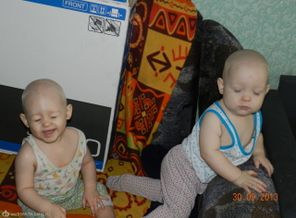 Лысики