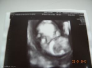 DSCN4432
