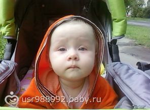 SP_A1419