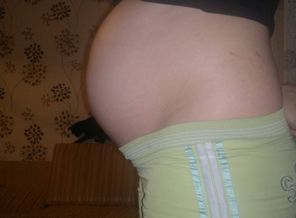 нам 36 неделек