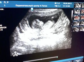 12 неделек