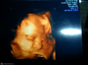 SAM_0281