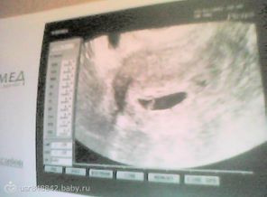 Picture0381