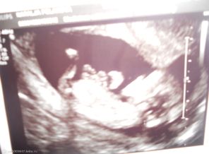 UZI 12.03.2013