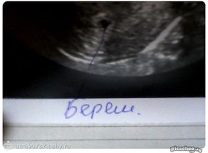 вот оно наше чудо:*