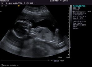 01/11/2013 года -МАЛЬЧИК!!!! 18,5 недель)))))