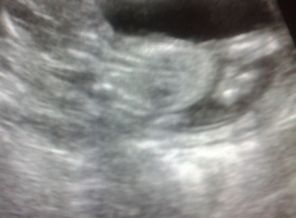 2012-06-19 13.09.04